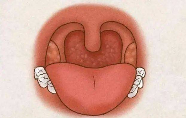 咽干是什么原因造成的